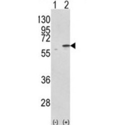 Protein Disulfide Isomerase A3 (PDIA3) Antibody