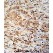 Peroxiredoxin 1 (PRDX1) Antibody