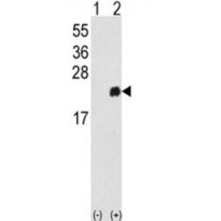 Peroxiredoxin 1 (PRDX1) Antibody