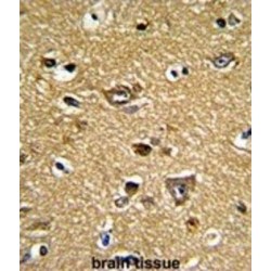 Peroxiredoxin 2 (PRDX2) Antibody