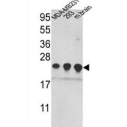 Peroxiredoxin 2 (PRDX2) Antibody