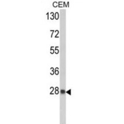 Peroxiredoxin 6 (PRDX6) Antibody