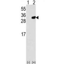 Peroxiredoxin 6 (PRDX6) Antibody