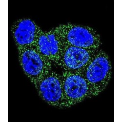 Glutathione S-Transferase P (GSTP1) Antibody