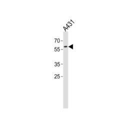 Paired Box Protein Pax-3 (PAX3) Antibody
