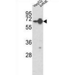Heterogeneous Nuclear Ribonucleoprotein L (HNRPL) Antibody