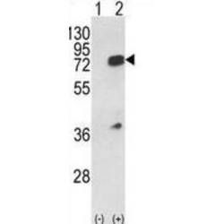 Heterogeneous Nuclear Ribonucleoprotein L (HNRPL) Antibody
