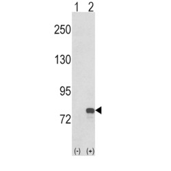 Guanine Monophosphate Synthase (GMPS) Antibody