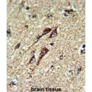 ATP Synthase Subunit Beta, Mitochondrial (ATP5F1B) Antibody