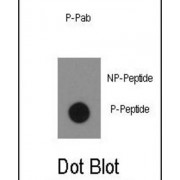 ABL1 (pY134) Antibody