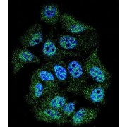 ABL1 (pY245) Antibody