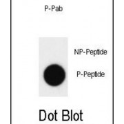 ABL (pY412) Antibody