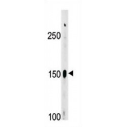 ABL (pY412) Antibody