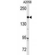 Tyrosine-Protein Kinase ABL2 (ABL) Antibody