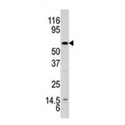 AKT (pY326) Antibody