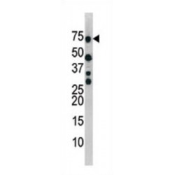 CDC25B (pS353) Antibody