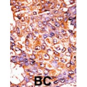 CDC2 (pT161) Antibody