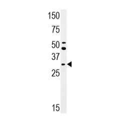 CDC2 (pT161) Antibody