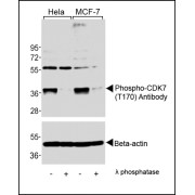 WB analysis of extracts of HeLa and MCF-7 cells, untreated or lamda phosphatase-treated, using CDK7 (pT170) Antibody (upper) or Beta-actin (lower).