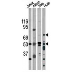 CHK1 (pS317) Antibody