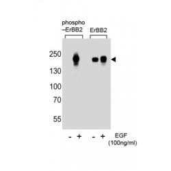 ErbB2 (pY1112) Antibody