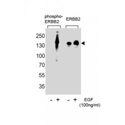ErbB2 (pY1248) Antibody