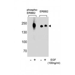 ErbB2 (pY1248) Antibody