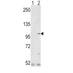 FGFR (pY653 / 654) Antibody