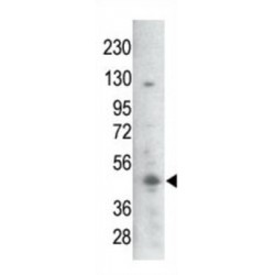 GSK3B (pS21 / 29) Antibody
