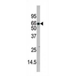 IL1R (pY496) Antibody