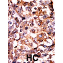 MAP Kinase-Activated Protein Kinase 2 Phospho-Thr334 (MAPKAPK2 pT334) Antibody