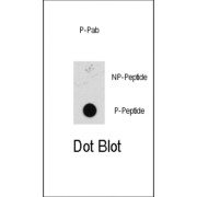 MEK1 (pS218 / 222) Antibody