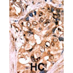 MEK1 (pS218 / 222) Antibody