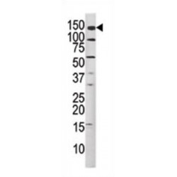 MET (pY1349) Antibody