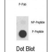 MET (pY1356) Antibody