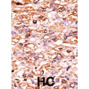 p27Kip1 (pS178) Antibody