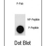 p53 (pS315) Antibody