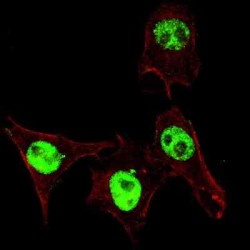 SMAD3 (pS208) Antibody