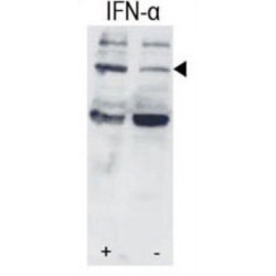 Signal Transducer and Activator of Transcription 3 Phospho-Ser727 (STAT3 pS727) Antibody