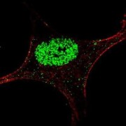 Signal Transducer and Activator of Transcription 5A Phospho-Tyr694 (STAT5A pY694) Antibody