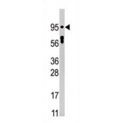 Signal Transducer and Activator of Transcription 5A Phospho-Tyr694 (STAT5A pY694) Antibody