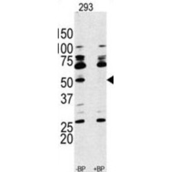 Ribosomal Protein S6 Kinase Beta-1 (S6K) Antibody