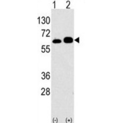 Ribosomal Protein S6 Kinase Beta-1 (S6K) Antibody