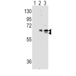 Ribosomal Protein S6 Kinase Beta-1 (S6K) Antibody