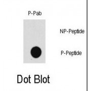 MAP3K7 (pT187) Antibody