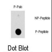 HSPB1 (pS78) Antibody