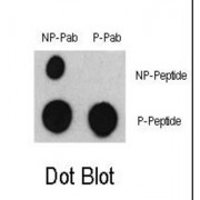 ATF2 (pS322) Antibody