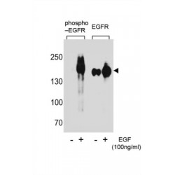 EGFR (pY1172) Antibody
