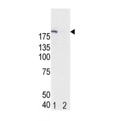 EGFR (pY1172) Antibody