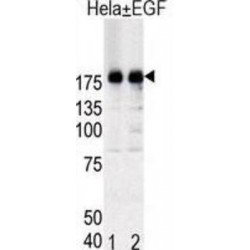 EGFR (pY1092) Antibody